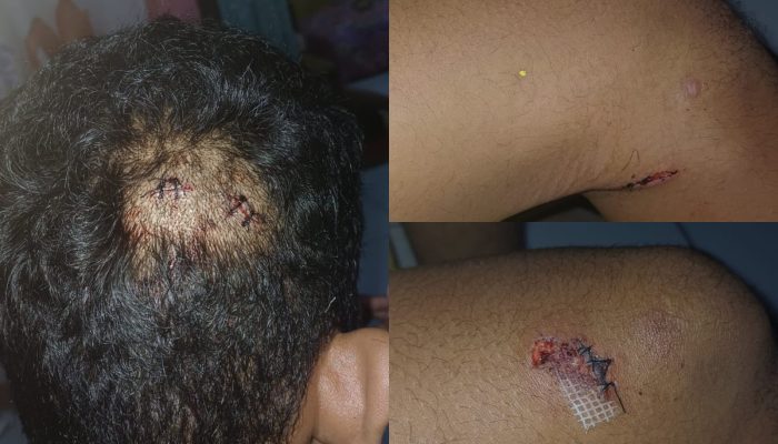 Seorang Pemuda di Kendari jadi Korban Pembacokan, Pelaku Diduga Mahasiswa